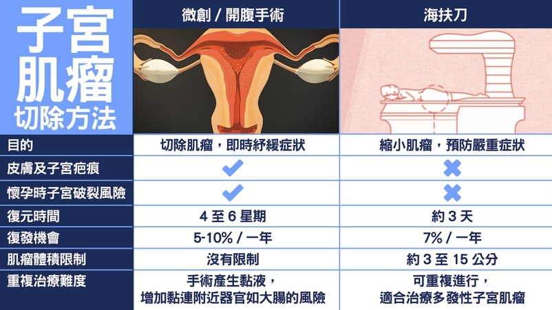 子宮肌瘤治療方法一覽。