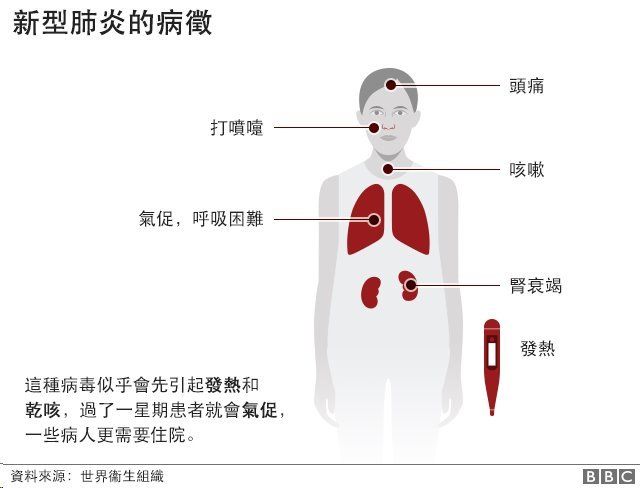 新冠肺炎病症