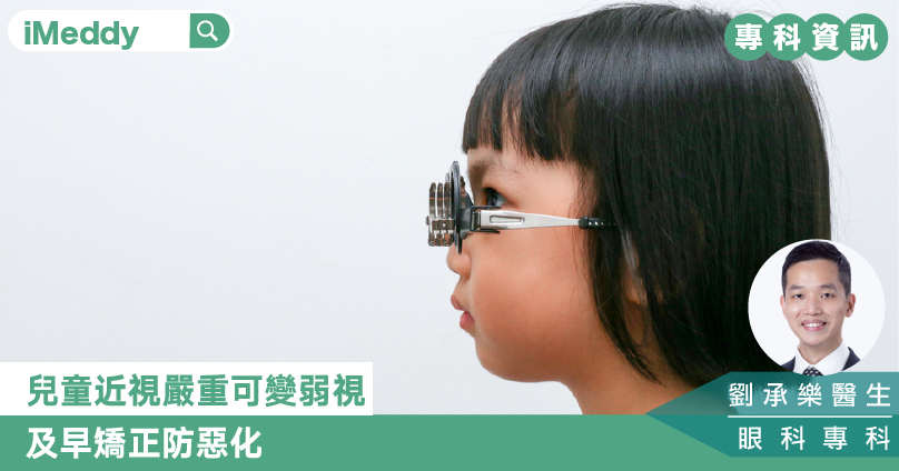 兒童近視嚴重可變弱視 及早矯正防惡化