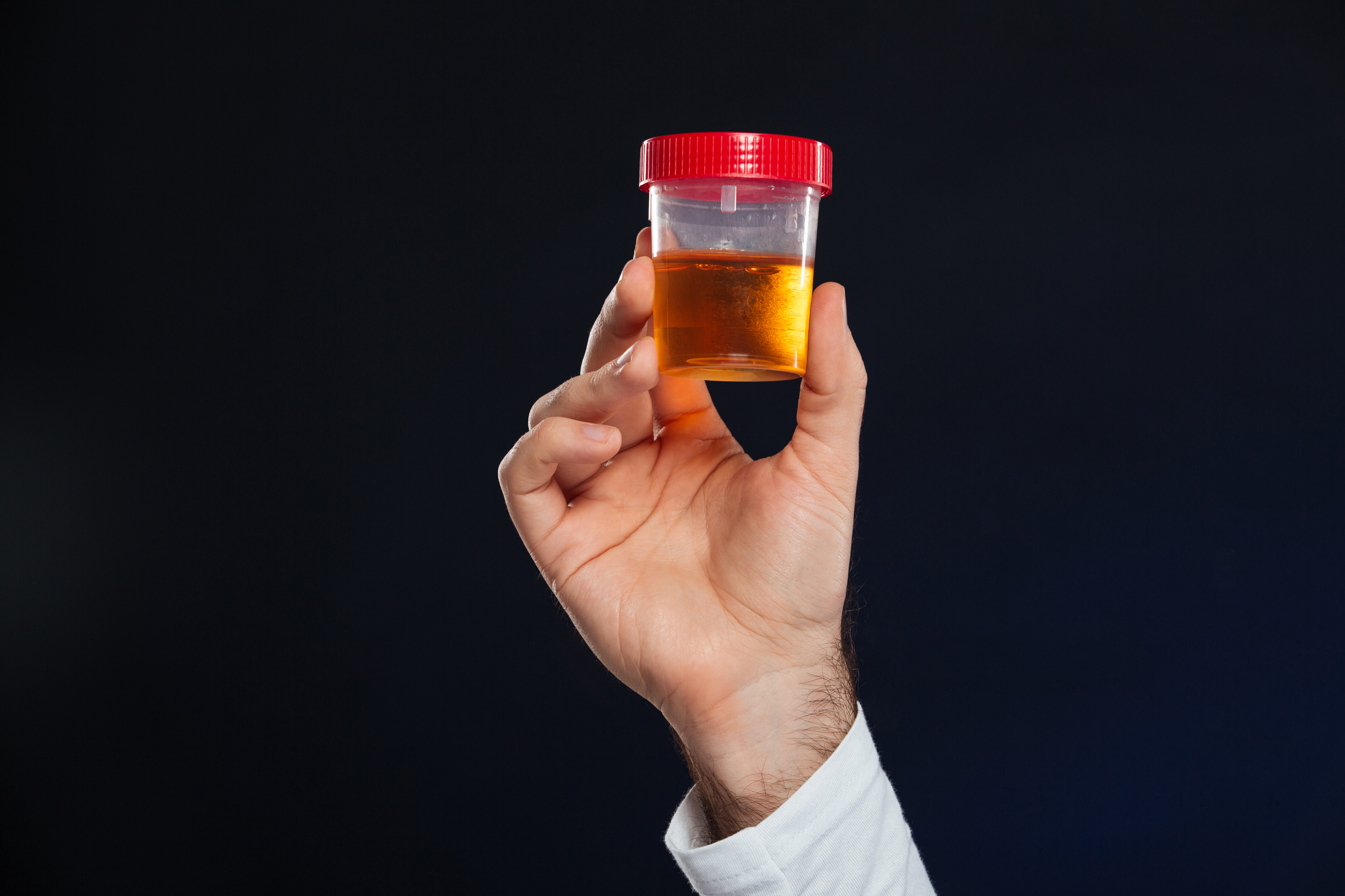 close-up-male-s-hand-holding-container-with-urine-sample.jpg