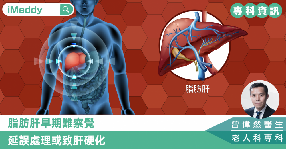 脂肪肝早期難察覺 延誤處理或致肝硬化