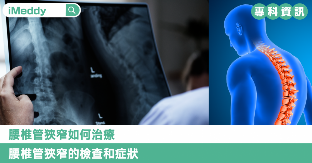 腰椎管狹窄如何治療 腰椎管狹窄的檢查和症狀