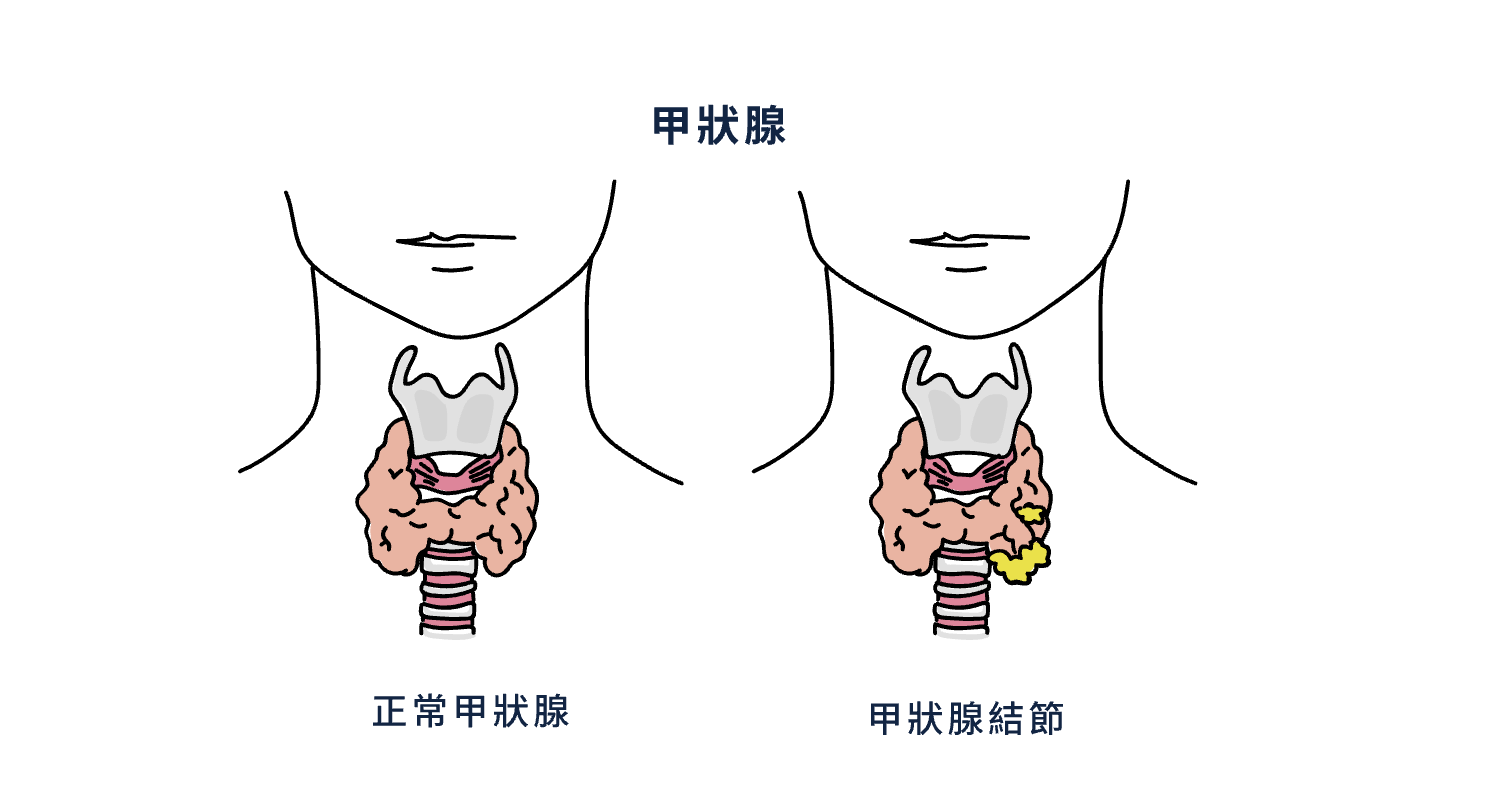 螢幕截圖 2021-09-13 下午4.22.33.png