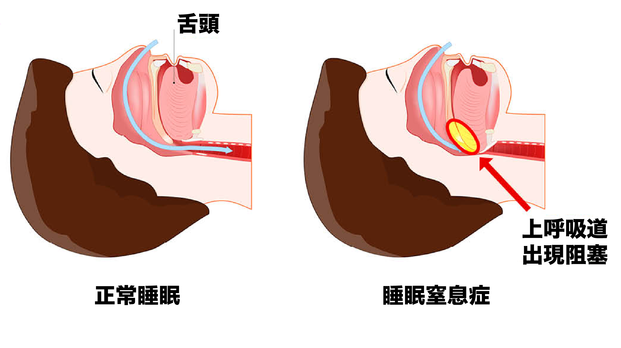 1022睡眠-12.png