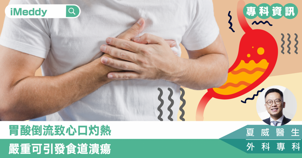 夏威醫生 — 胃酸倒流致心口灼熱 嚴重可引發食道潰瘍