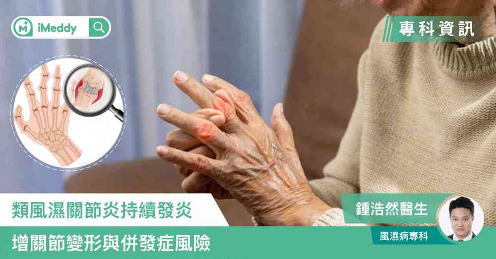 鍾浩然醫生 — 類風濕關節炎持續發炎 增關節變形與併發症風險