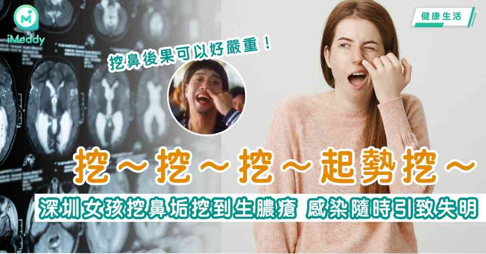 ​挖挖挖起勢挖  深圳女孩挖鼻垢挖到生膿瘡 感染隨時引致失明