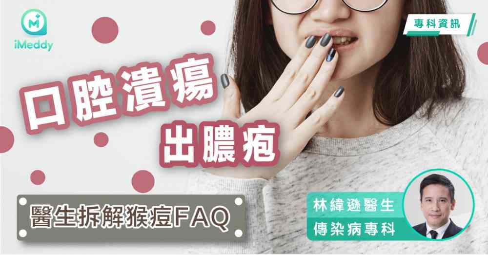 林緯遜醫生 — 口腔潰瘍出膿疱 醫生拆解猴痘FAQ