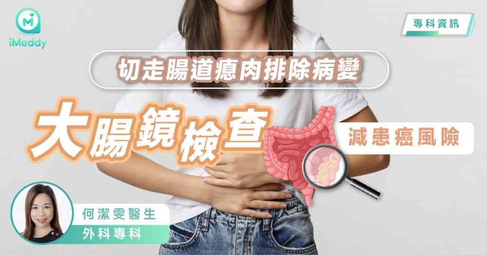 何潔雯醫生 — 切走腸道瘜肉排除病變 大腸鏡檢查減患癌風險