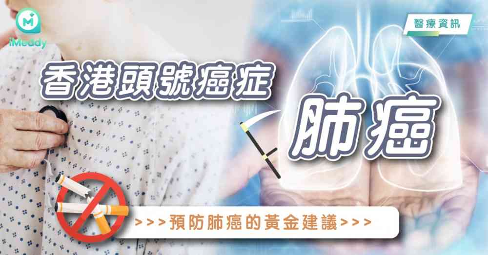 香港頭號癌症–肺癌 預防肺癌的黃金建議